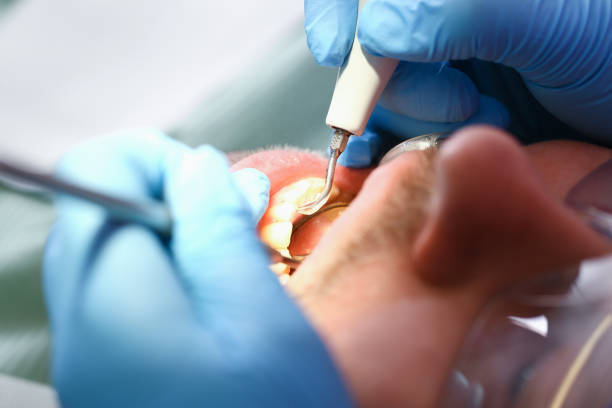 Best Chipped Tooth Repair Near Me  in Louisburg, KS